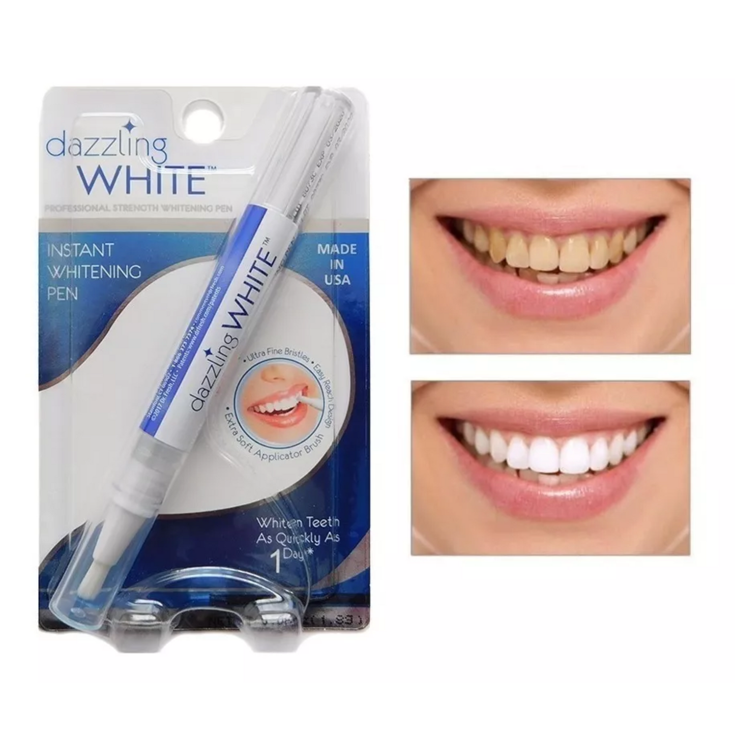 BrilloMax™ - Lápiz blanqueador dental