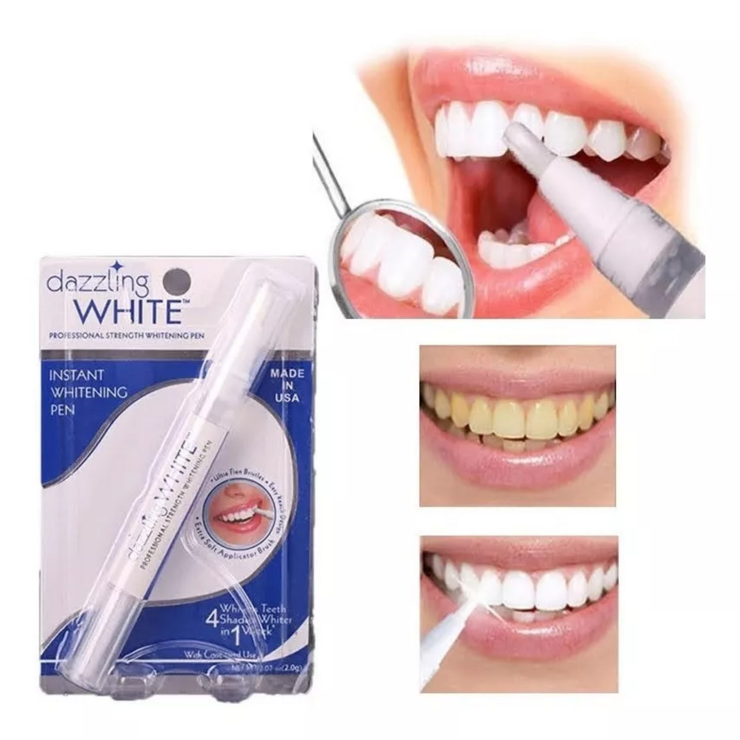 BrilloMax™ - Lápiz blanqueador dental